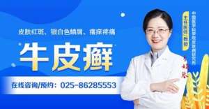重磅揭秘：南京治疗牛皮癣的医院_南京牛皮癣医院排名