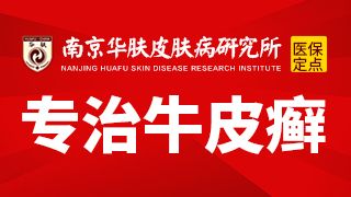 公开宣布：南京治疗牛皮癣比较好的医院是哪个“排名出炉”