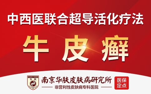 银屑病是怎么引起的“南京华肤皮肤病研究所官网预约”