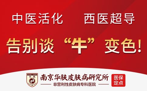 银屑病的症状表现“南京华肤皮肤病研究所挂号”