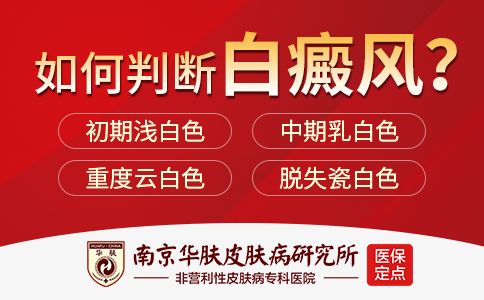 怎么预防出现白癜风症状“南京白癜风哪里治疗好”