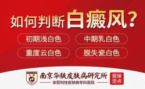 怎么预防出现白癜风症状“南京白癜风哪里治疗好”